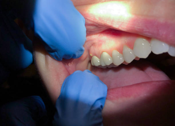 Best Emergency TMJ Treatment in Twin Falls, ID